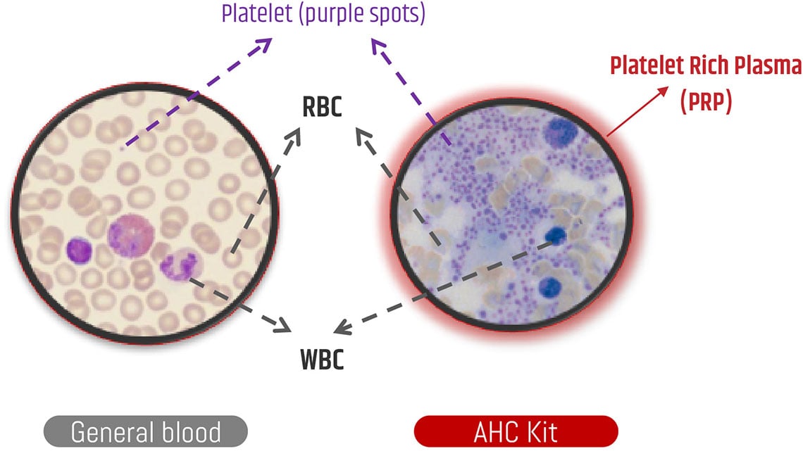 img_ahc-kit img_ahc-kit